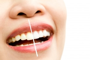 Cosmetic Dentistry Mountain View CA